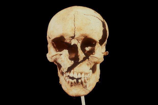 Skull of a Lancastrian soldier whose head was struck with a 