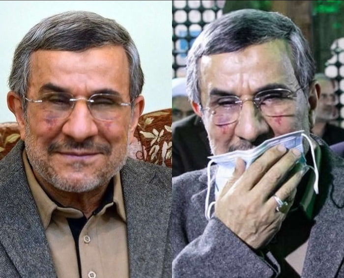Ahmadinejad has done plastic surgery. Look at his stupid fac Image
