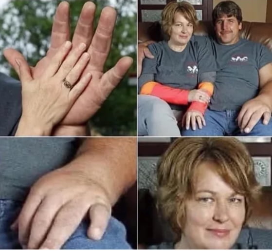 Wife opens up about her husband's large hand palms and finge