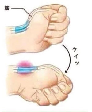 How to break your tendon. I had to try it twice to be sure i Image