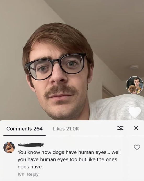 Dog eyes/Human eyes Image