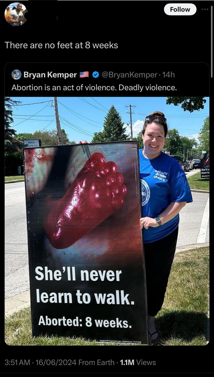 Why is EVERY SINGLE “pro-lifer” such a f**king DUMBASS?